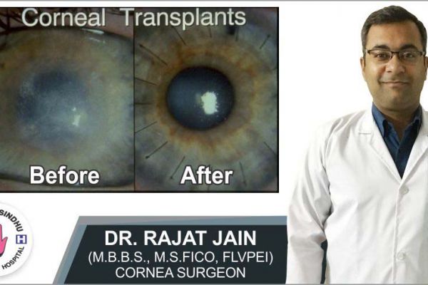 Corneal Transplant