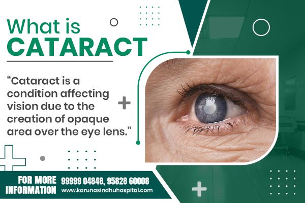 What is Cataract